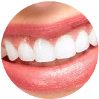 Estetica dental